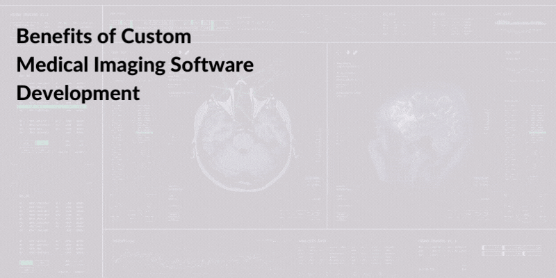 Benefits of Custom Medical Imaging Software Development